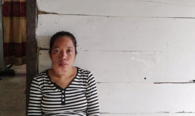 Terkena Tumor Rahang, Tutik Warga Lampung Tengah Butuh Biaya Untuk Operasi