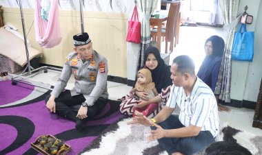 Kapolres Pidie Kunjungi Anak Bibir Sumbing, Hadirkan Harapan Lewat Operasi Gratis