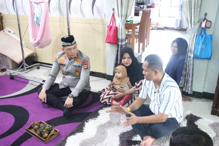 Kapolres Pidie Kunjungi Anak Bibir Sumbing, Hadirkan Harapan Lewat Operasi Gratis