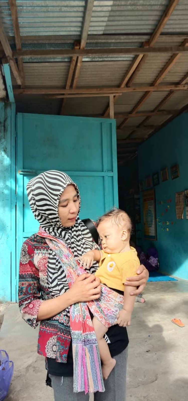 Ananda Fayza Nayra Mengidab Penyakit SuspatrioventriCular Septal Defec, Butuh Perhatian Serius Dari Para Dermawan
