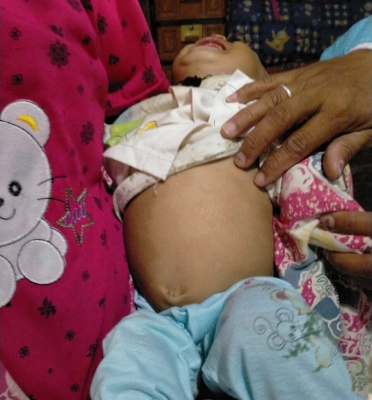Galen (8 Bulan) Mengalami Pembengkakan Perut Butuh uluran tangan para Darmawan