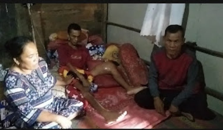 Herfika Yunanda Remaja 18 tahun Terbaring Lemah Dirumahnya dan terus berjuang, melawan penyakitnya