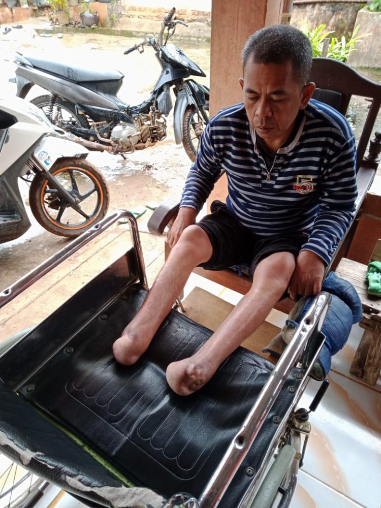 Muhtar Aman Harap kan Kaki palsu warga asal kampung Curup Patah Kecamatan Gunung labuhan Kabupaten WayKanan Butuh bantuan dan perhatian dari pihak pemerintah terkait