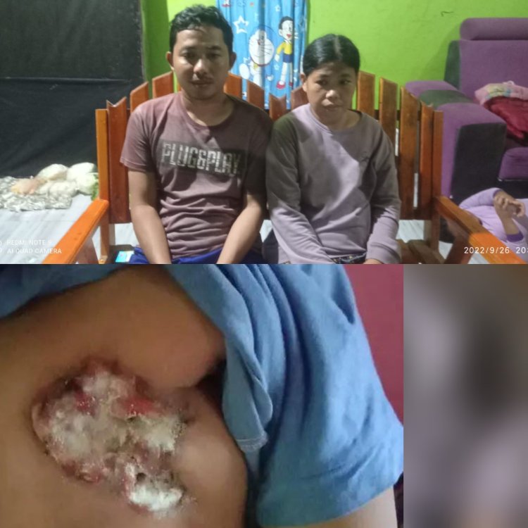 Keadaan Kasirah Penderita Kanker Payudara Memprihatinkan