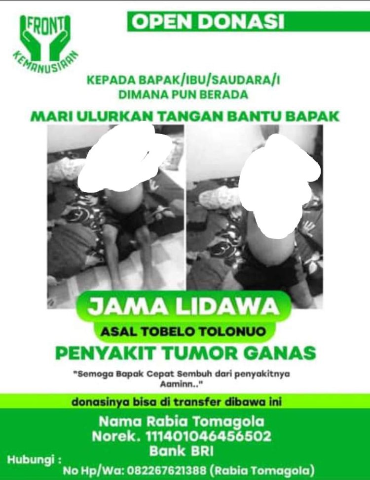 Jama Lidawa Mengalami Penyakit Tumor Membutukan Bantuan Biaya Dana Operasi