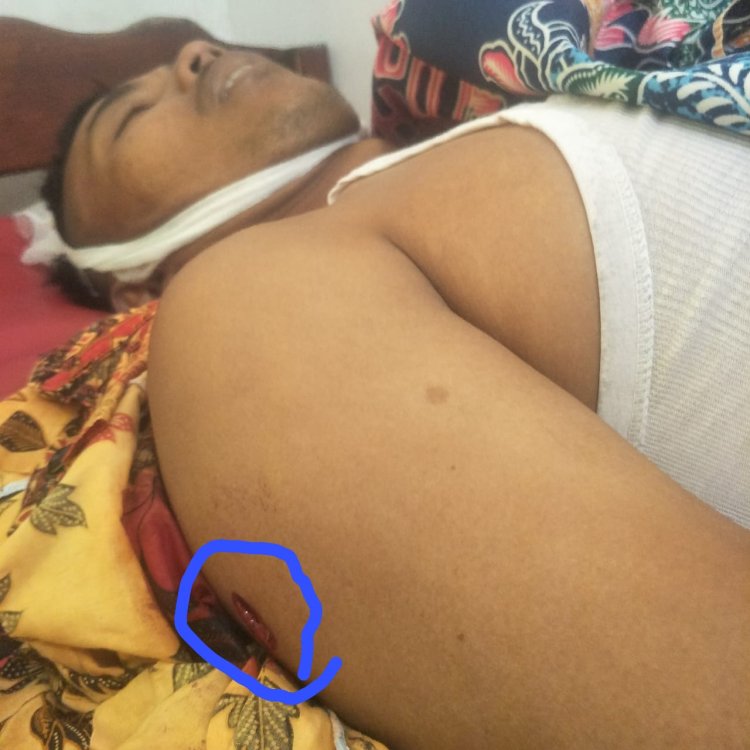 Aksi Begal Sadis kembali Menelan Korban - Warga Okut Tewas Ditembak Begal