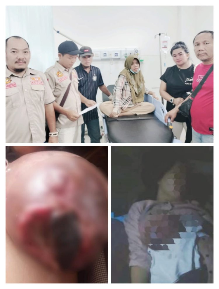 Warga Air Paoh Liliyasari (36) penderita kanker payudara Membutuhkan Bantuan Dari Para Dermawan
