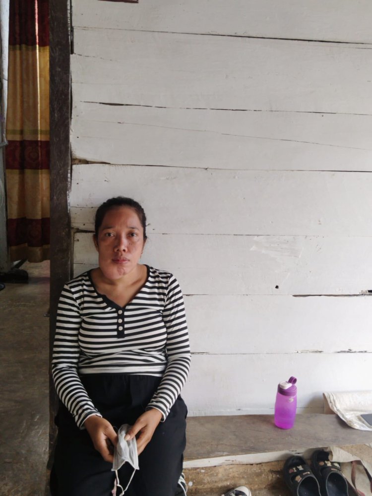 Terkena Tumor Rahang, Tutik Warga Lampung Tengah Butuh Biaya Untuk Operasi